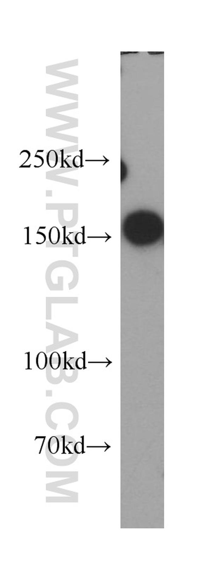 SAFB Antibody in Western Blot (WB)