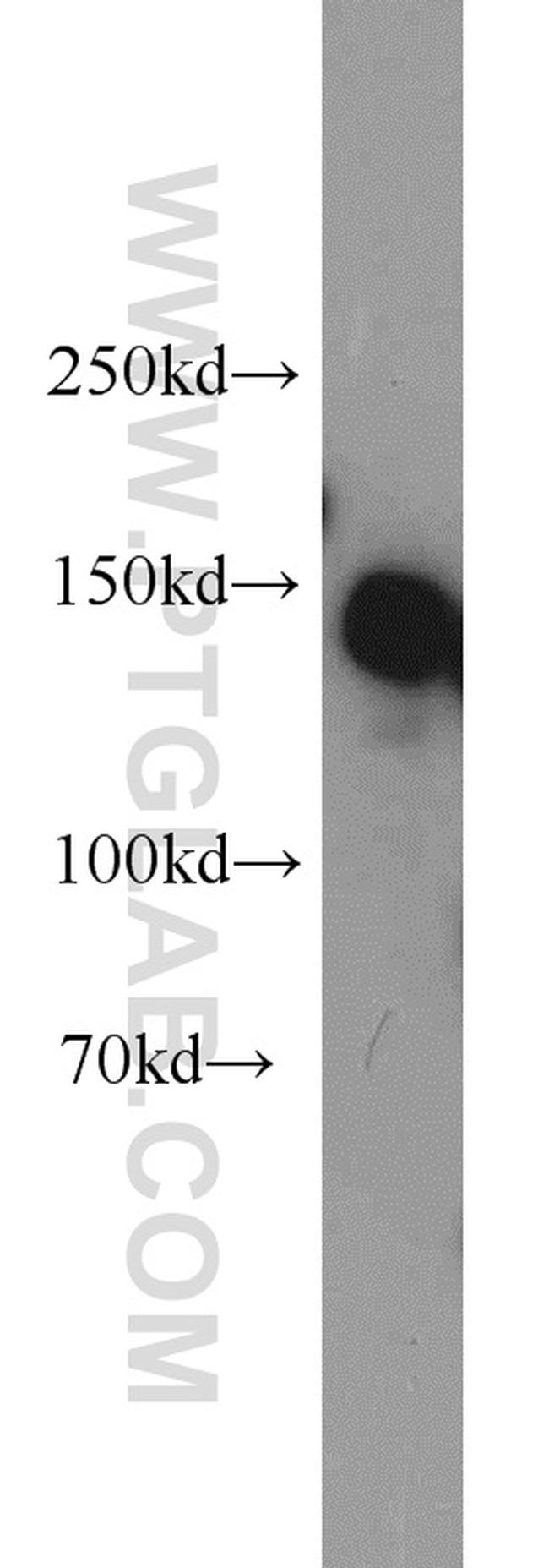 SAFB Antibody in Western Blot (WB)