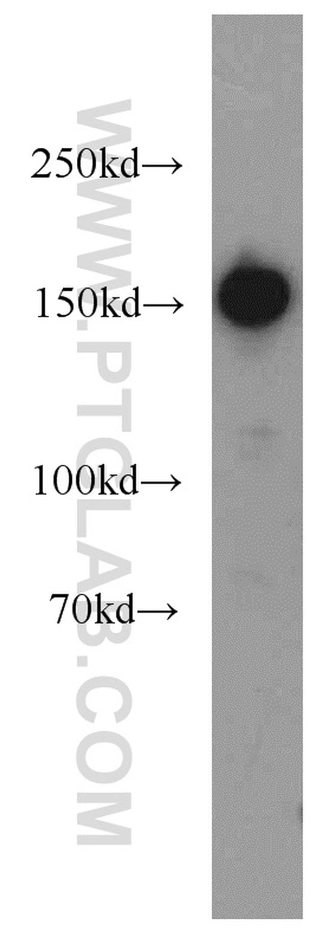 SAFB Antibody in Western Blot (WB)