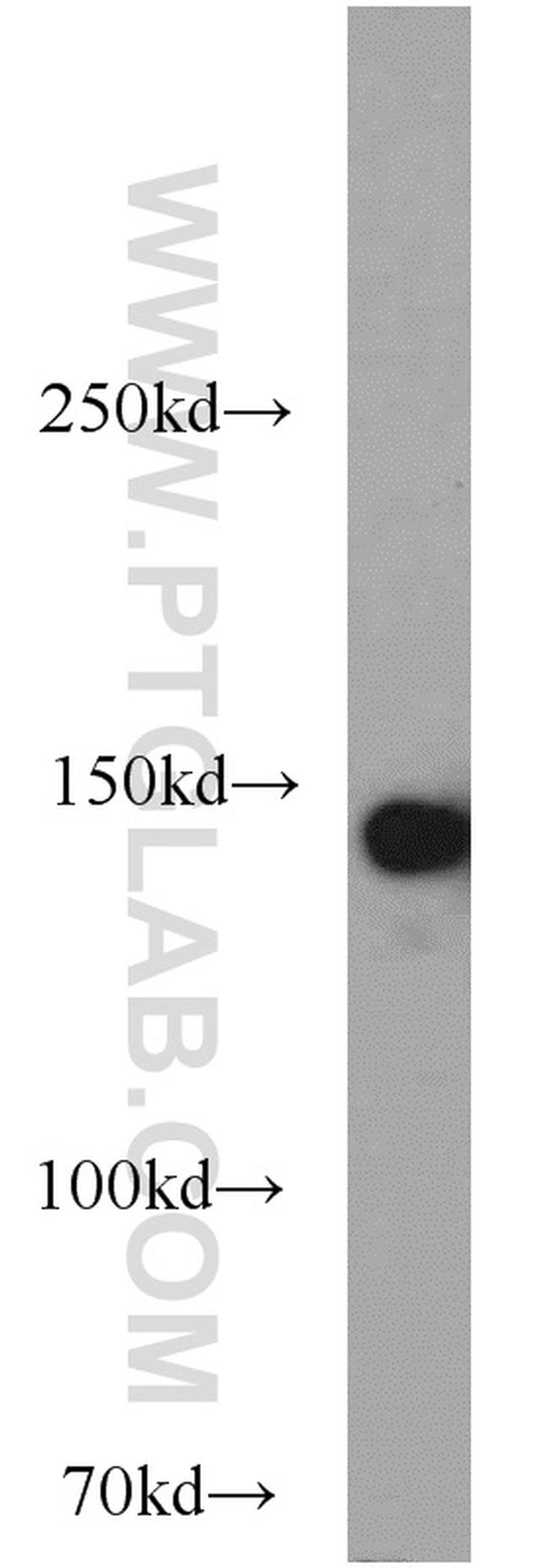 SAFB Antibody in Western Blot (WB)