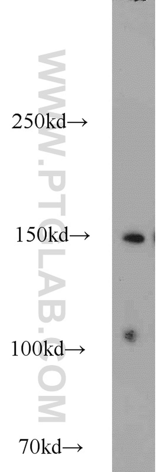 SAFB Antibody in Western Blot (WB)