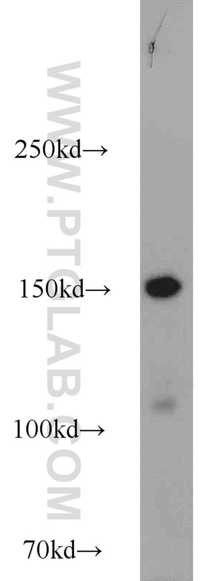 SAFB Antibody in Western Blot (WB)