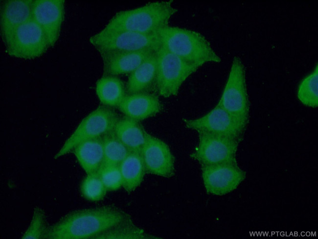 DOCK4 Antibody in Immunocytochemistry (ICC/IF)