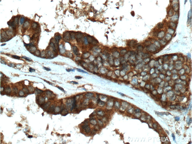 DOCK4 Antibody in Immunohistochemistry (Paraffin) (IHC (P))