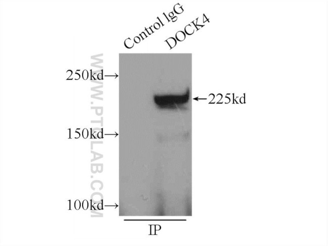 DOCK4 Antibody in Immunoprecipitation (IP)