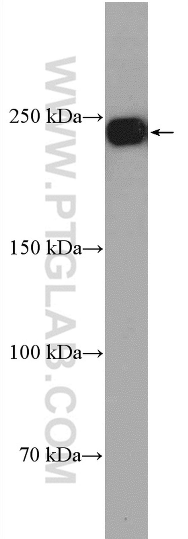 DOCK4 Antibody in Western Blot (WB)