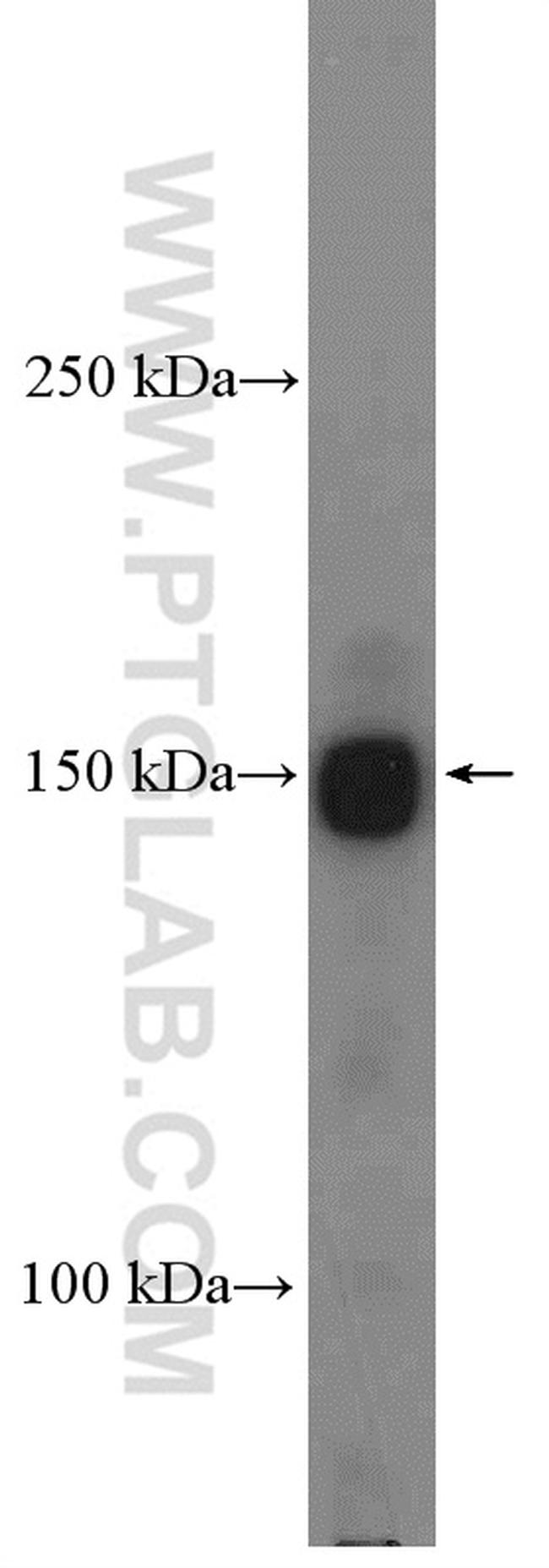 Intersectin 1 Antibody in Western Blot (WB)