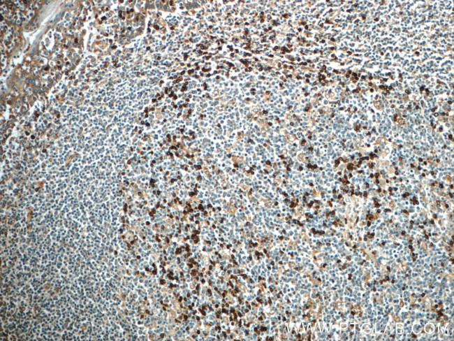 IL-6 Antibody in Immunohistochemistry (Paraffin) (IHC (P))