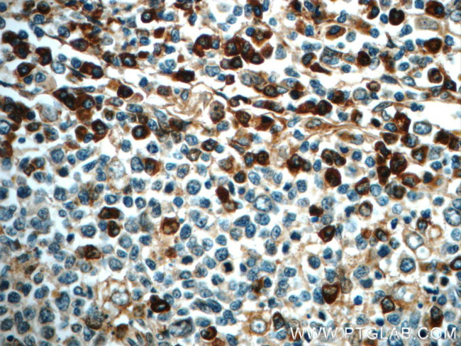 IL-6 Antibody in Immunohistochemistry (Paraffin) (IHC (P))