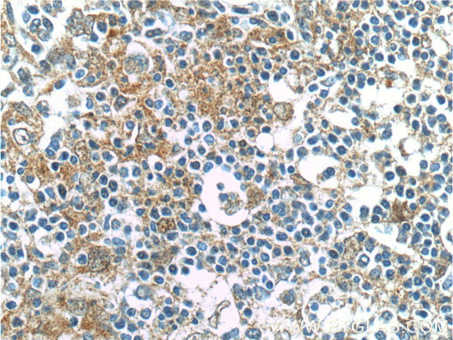 IL-6 Antibody in Immunohistochemistry (Paraffin) (IHC (P))