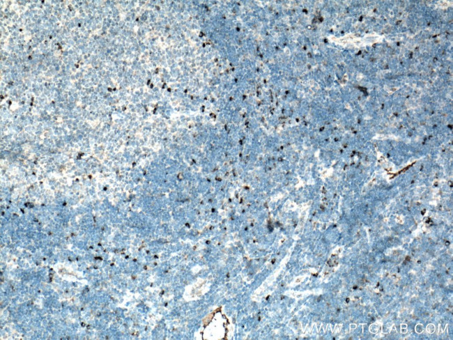 IL-6 Antibody in Immunohistochemistry (Paraffin) (IHC (P))