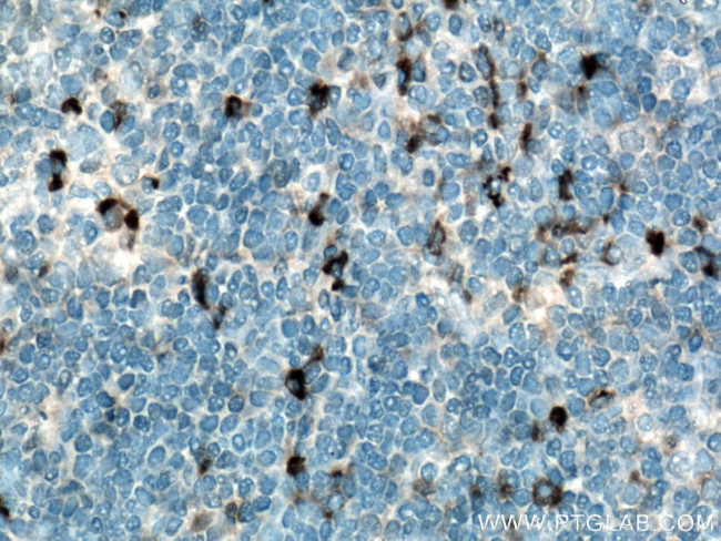 IL-6 Antibody in Immunohistochemistry (Paraffin) (IHC (P))