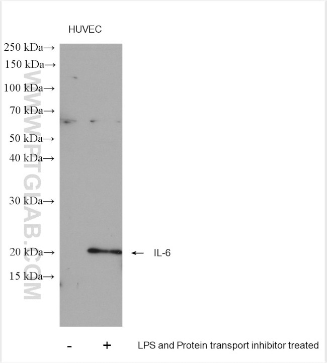 IL-6 Antibody in Western Blot (WB)