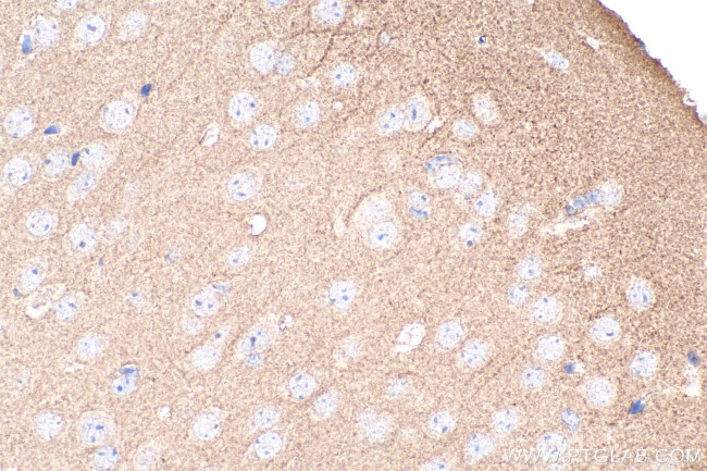 EPHA4 Antibody in Immunohistochemistry (Paraffin) (IHC (P))