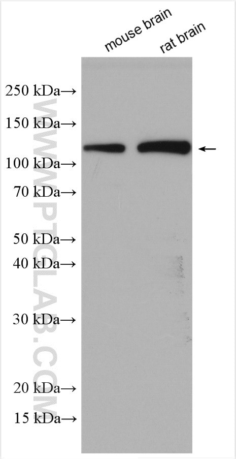 EPHA4 Antibody in Western Blot (WB)