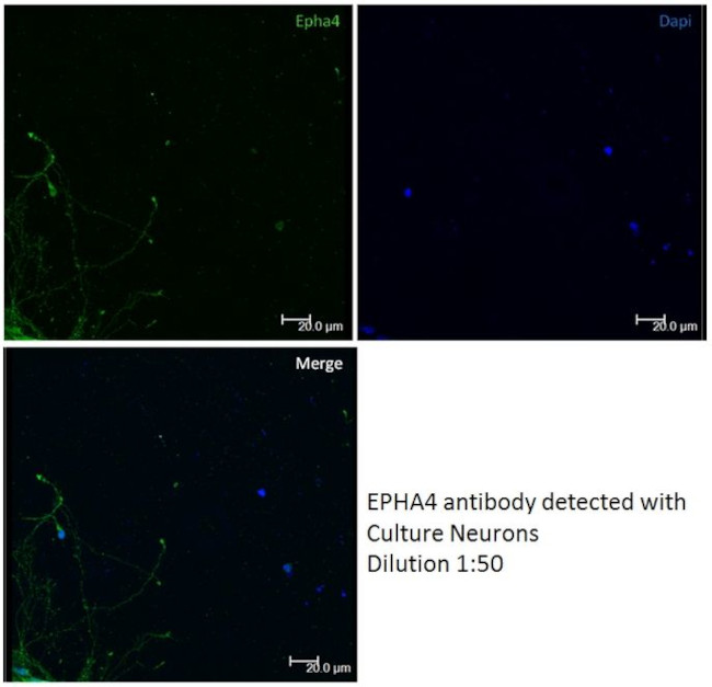 EPHA4 Antibody in Immunocytochemistry (ICC/IF)