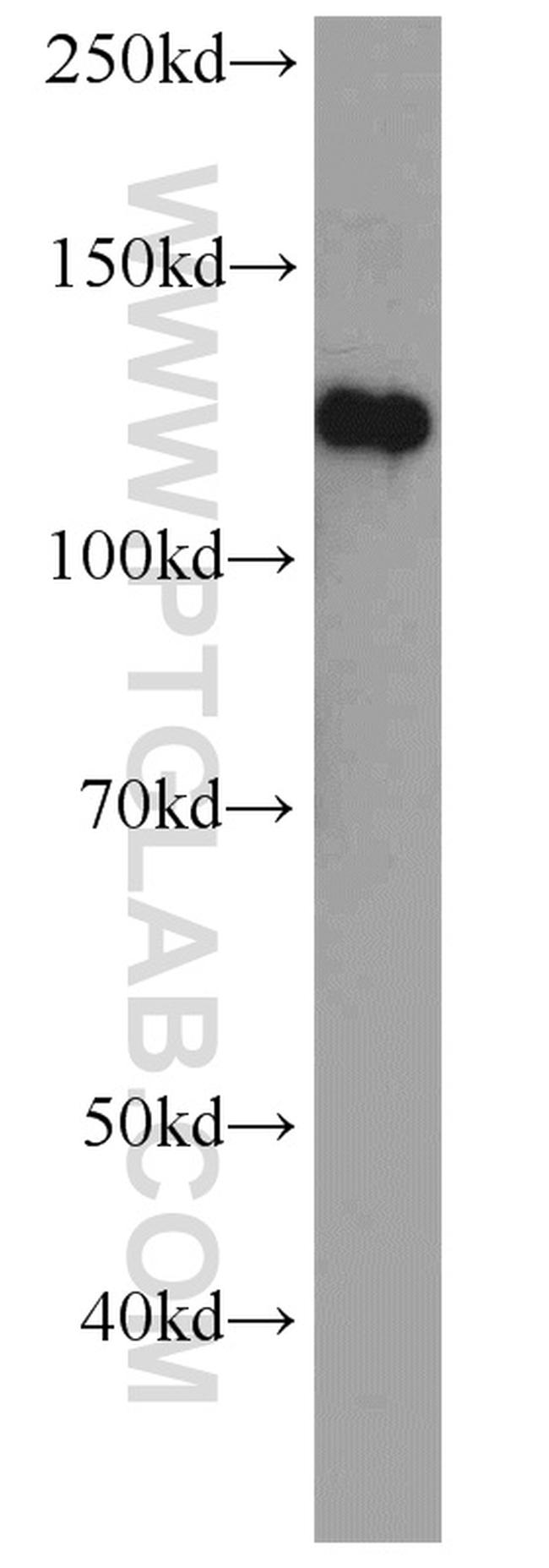 EPHA4 Antibody in Western Blot (WB)