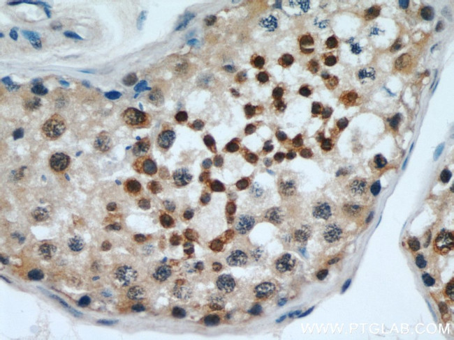 EDRF1 Antibody in Immunohistochemistry (Paraffin) (IHC (P))