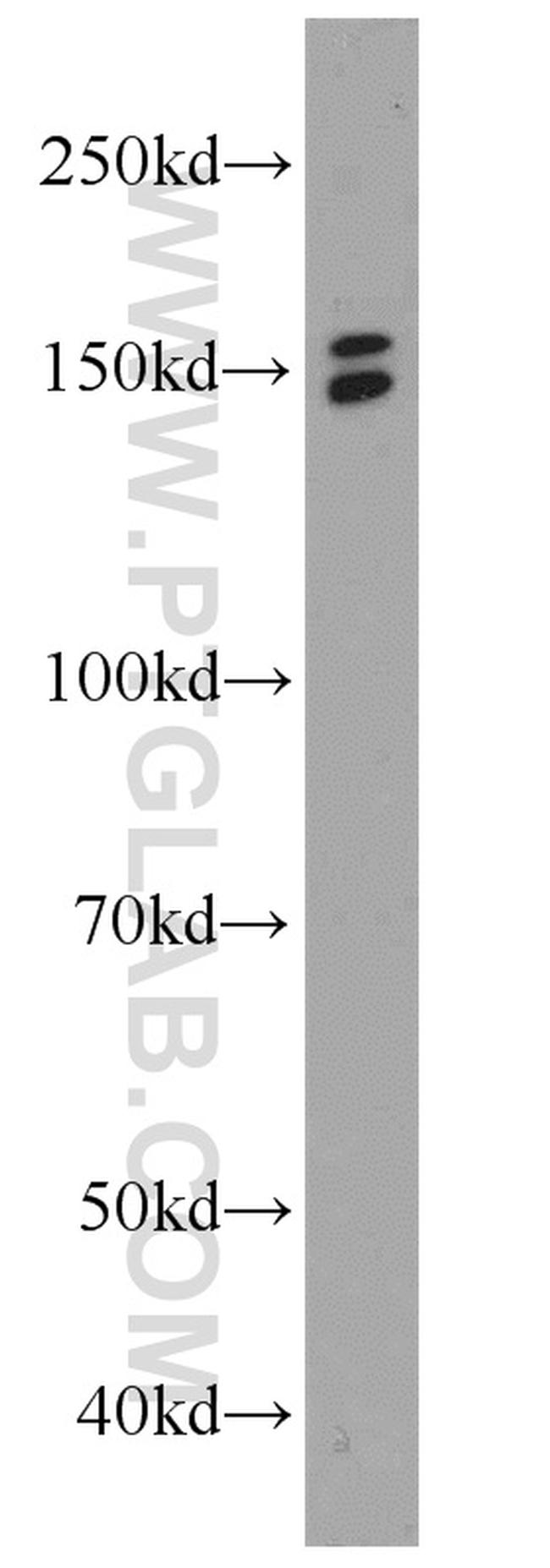 EDRF1 Antibody in Western Blot (WB)