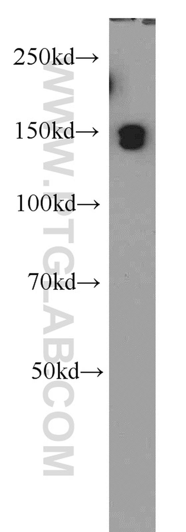 EDRF1 Antibody in Western Blot (WB)