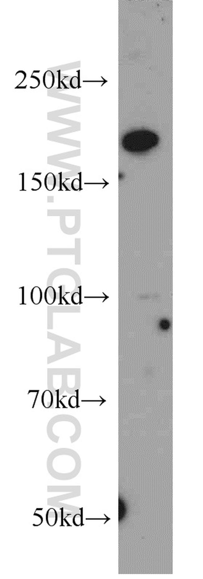 EDRF1 Antibody in Western Blot (WB)