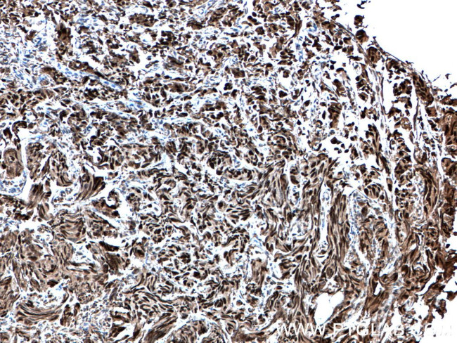 P53 Antibody in Immunohistochemistry (Paraffin) (IHC (P))