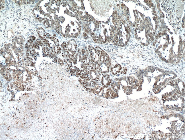 P53 Antibody in Immunohistochemistry (Paraffin) (IHC (P))