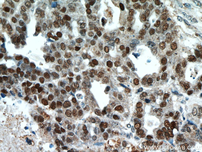 P53 Antibody in Immunohistochemistry (Paraffin) (IHC (P))