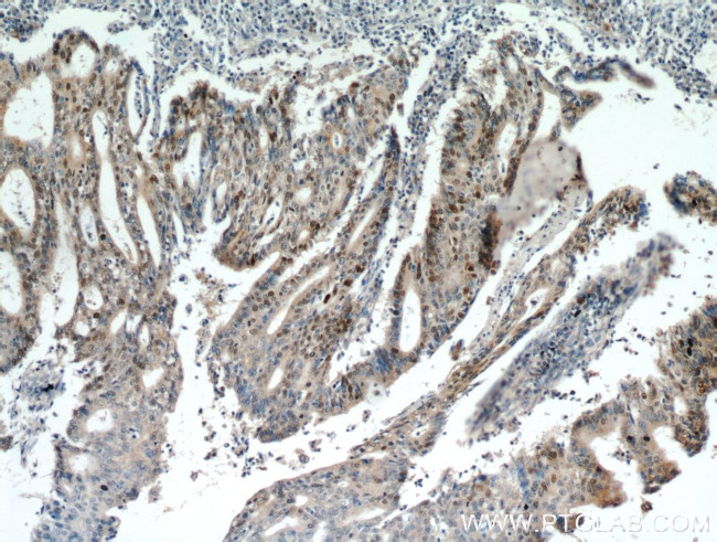 P53 Antibody in Immunohistochemistry (Paraffin) (IHC (P))