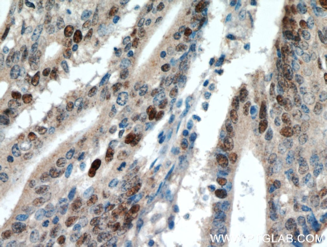 P53 Antibody in Immunohistochemistry (Paraffin) (IHC (P))