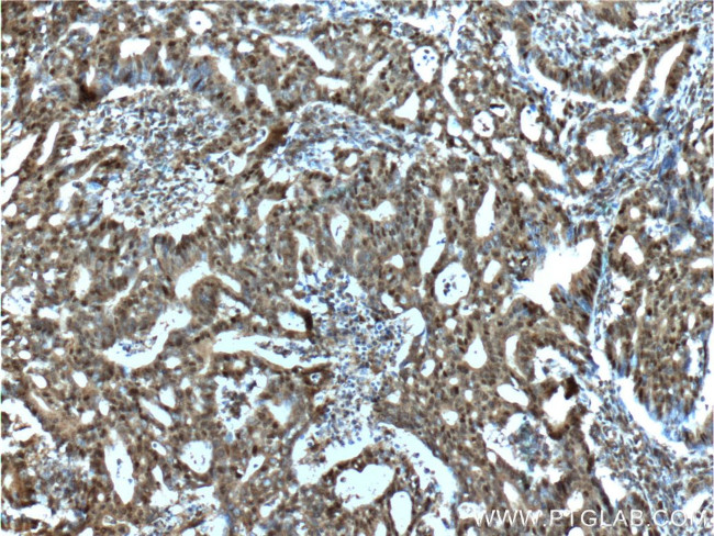 P53 Antibody in Immunohistochemistry (Paraffin) (IHC (P))