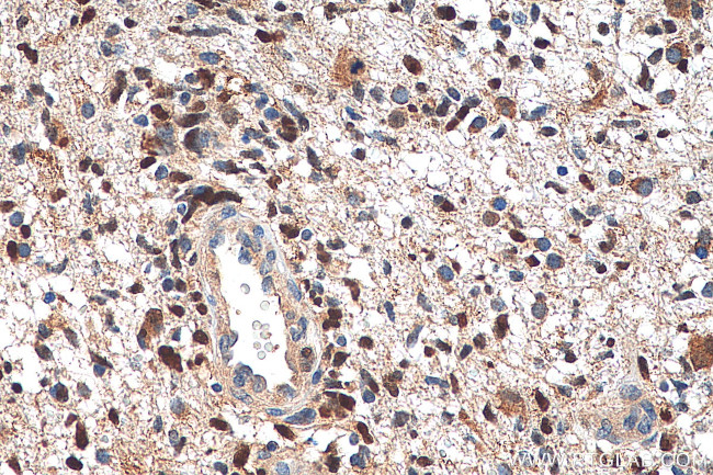 P53 Antibody in Immunohistochemistry (Paraffin) (IHC (P))