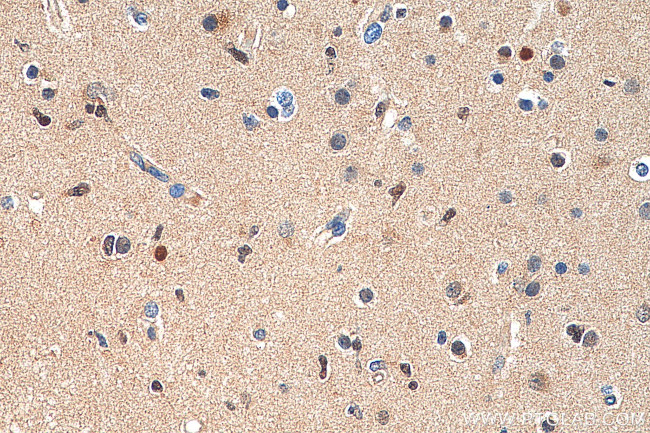 P53 Antibody in Immunohistochemistry (Paraffin) (IHC (P))