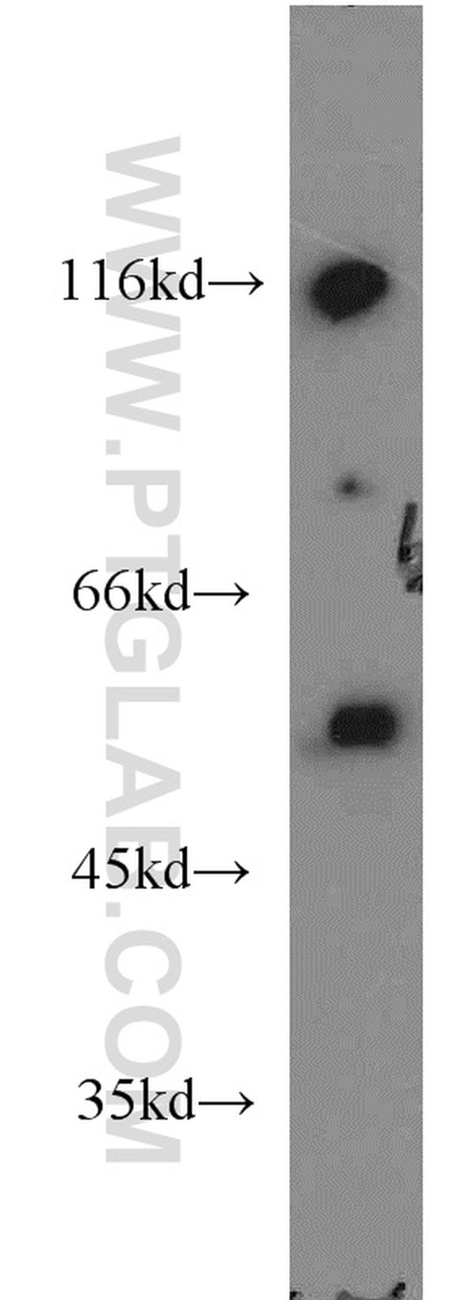 P53 Antibody in Western Blot (WB)