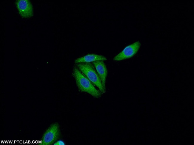 P53 Antibody in Immunocytochemistry (ICC/IF)