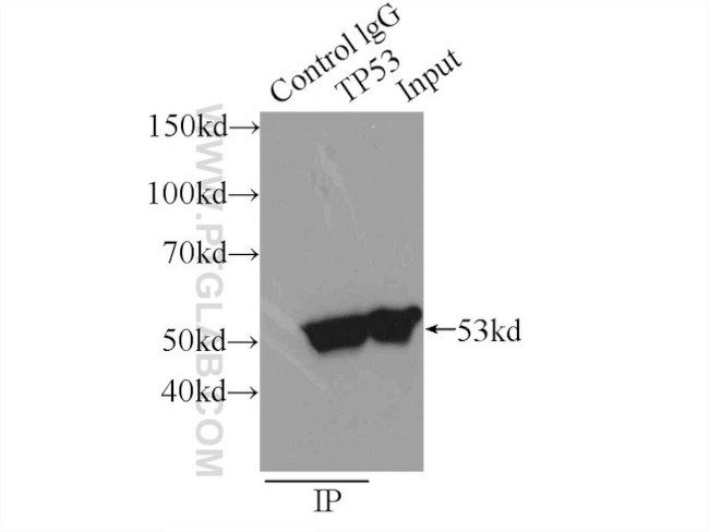 P53 Antibody in Immunoprecipitation (IP)