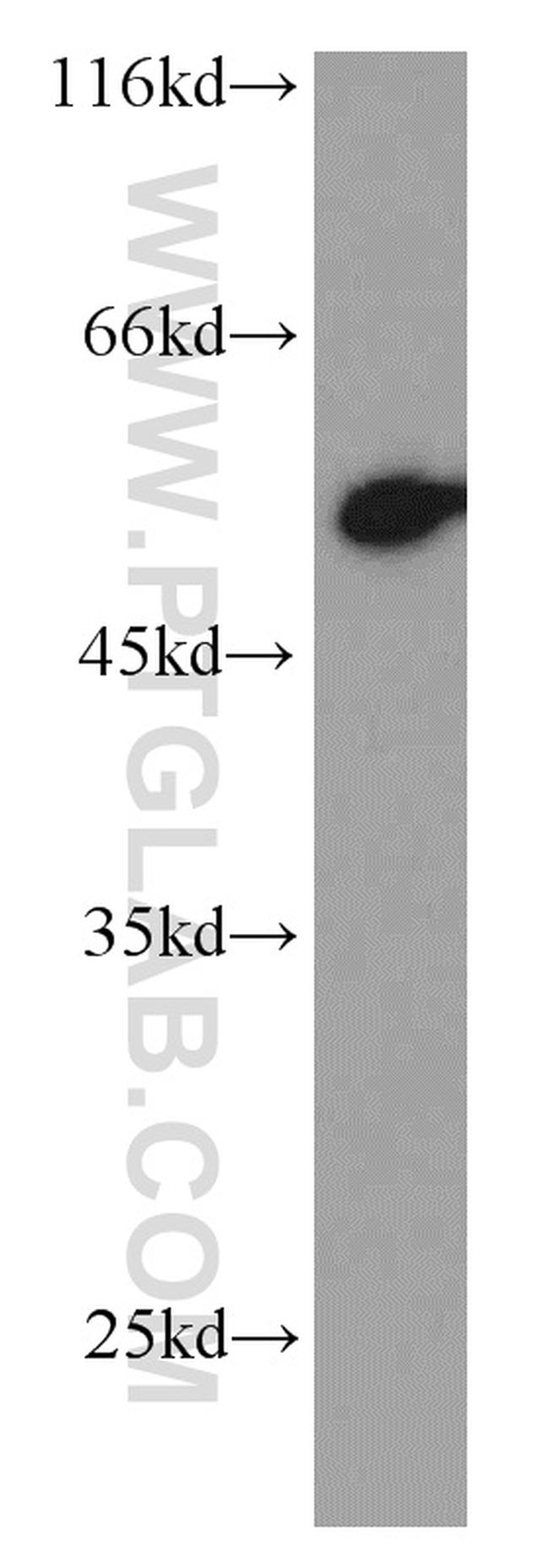 P53 Antibody in Western Blot (WB)