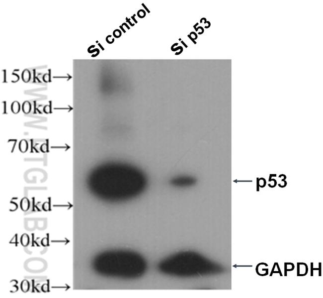 P53 Antibody in Western Blot (WB)