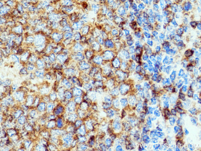 CD22 Antibody in Immunohistochemistry (Paraffin) (IHC (P))