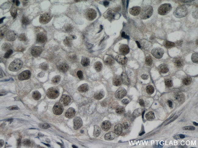 ZBTB38 Antibody in Immunohistochemistry (Paraffin) (IHC (P))