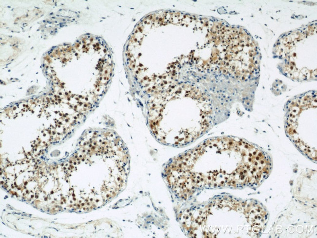 ZBTB38 Antibody in Immunohistochemistry (Paraffin) (IHC (P))