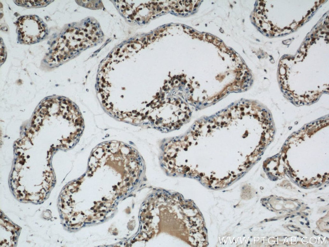 ZBTB38 Antibody in Immunohistochemistry (Paraffin) (IHC (P))