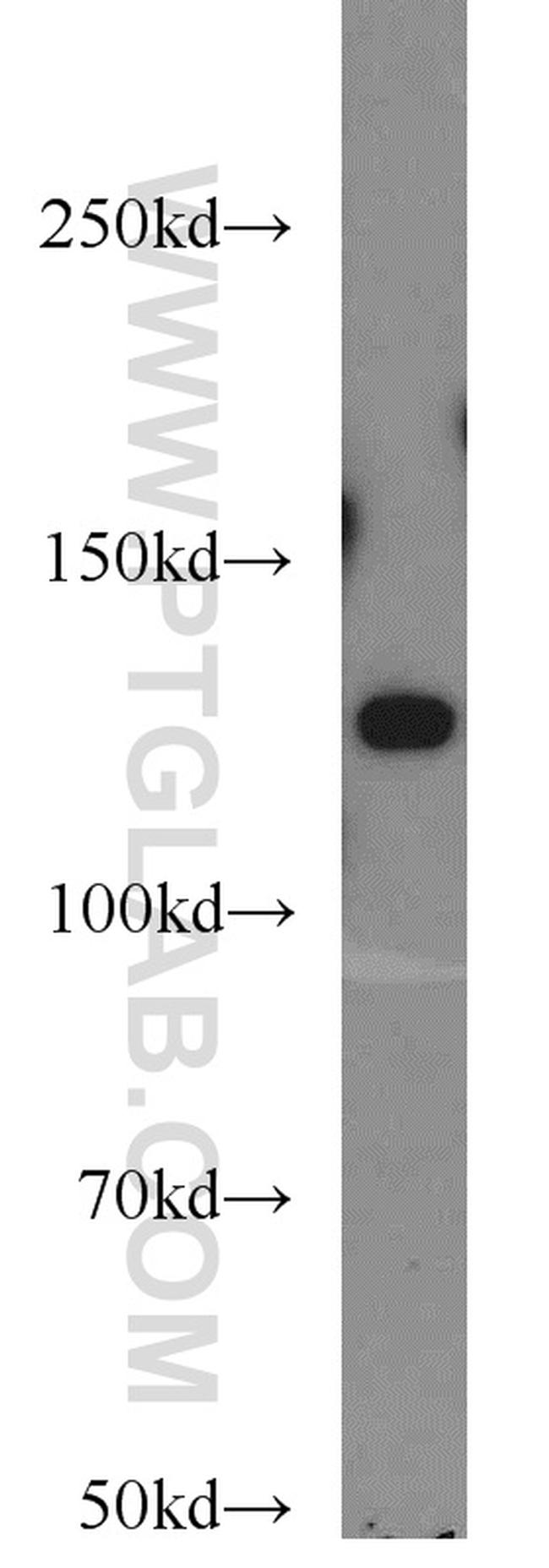 ZBTB38 Antibody in Western Blot (WB)