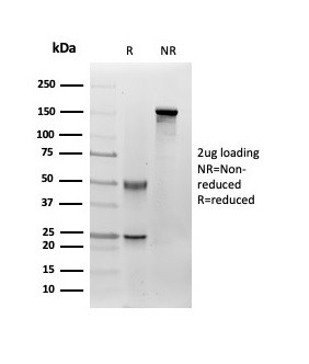 Fibroblast Activation Protein Alpha/FAP-1 Antibody in SDS-PAGE (SDS-PAGE)