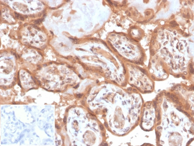 Fibroblast Activation Protein Alpha/FAP-1 Antibody in Immunohistochemistry (Paraffin) (IHC (P))