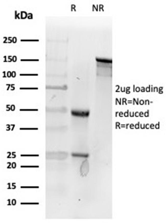 Fibroblast Activation Protein Alpha/FAP-1 Antibody in Immunoelectrophoresis (IE)