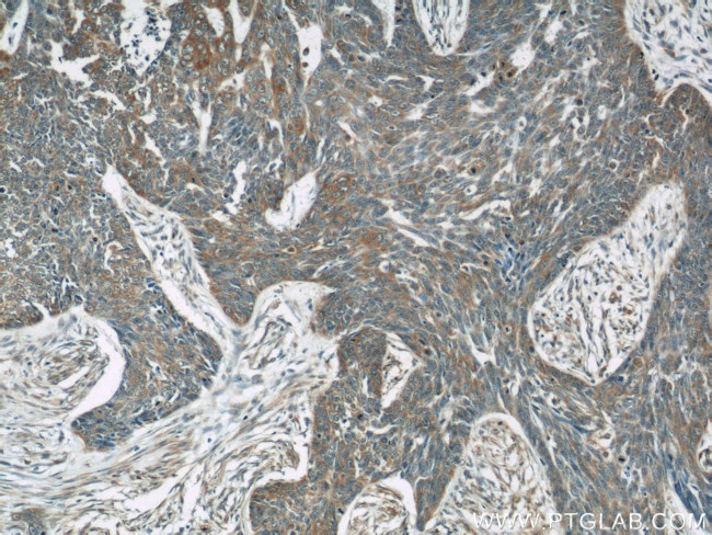 OAS3 Antibody in Immunohistochemistry (Paraffin) (IHC (P))