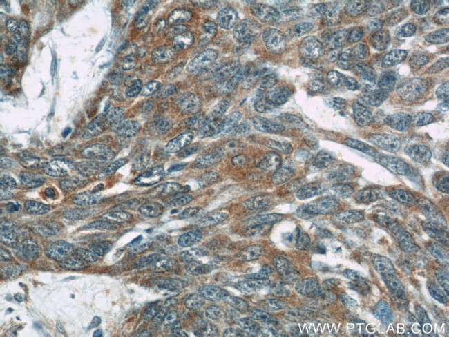 OAS3 Antibody in Immunohistochemistry (Paraffin) (IHC (P))