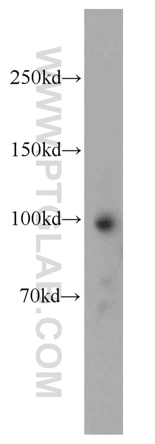 OAS3 Antibody in Western Blot (WB)