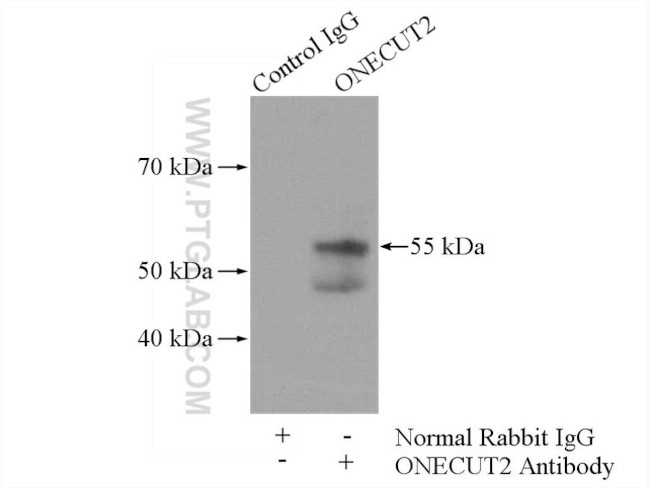 ONECUT2 Antibody in Immunoprecipitation (IP)